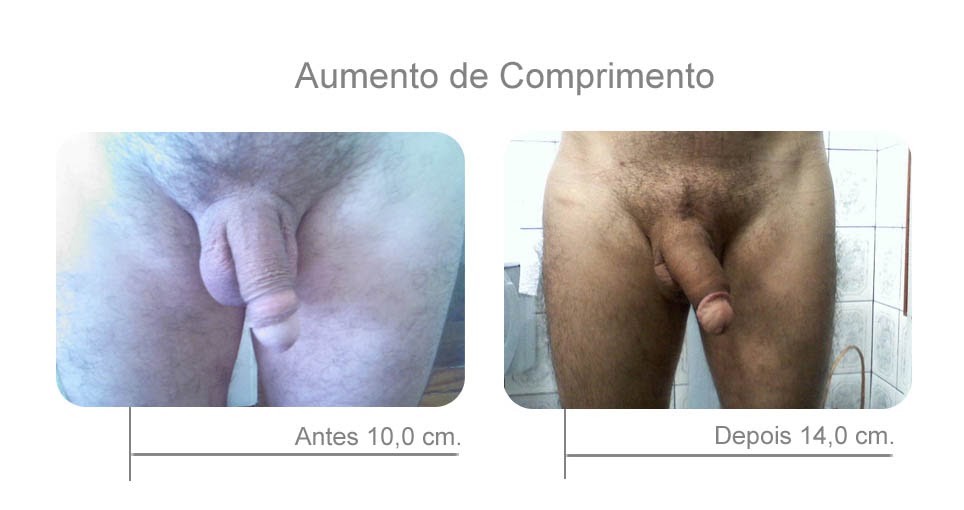 Porque tenho um pequeno pênis